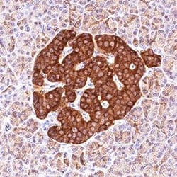 Invitrogen ICA1 Polyclonal Antibody 100 &mu;g; Unconjugated:Antibodies,