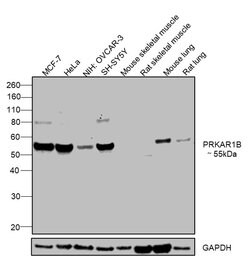 Invitrogen PRKAR1B Polyclonal Antibody 100 &mu;g | Buy Online | Invitrogen&trade; | Fisher Scientific