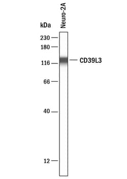 Invitrogen ENTPD3 Polyclonal Antibody 100 &mu;g; Unconjugated:Antibodies,