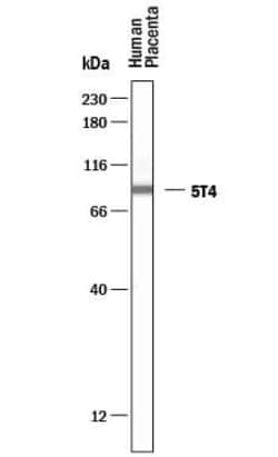 Invitrogen 5T4 Polyclonal Antibody 100 &mu;g; Unconjugated:Antibodies,