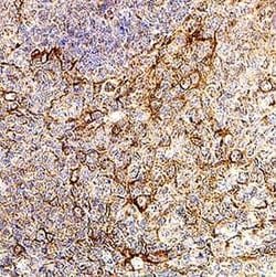 Invitrogen Ninjurin 2 Polyclonal Antibody 100 &mu;g; Unconjugated:Antibodies,