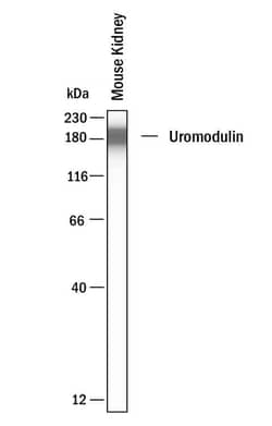 Invitrogen Uromodulin Polyclonal Antibody 100 &mu;g | Buy Online | Invitrogen&trade; | Fisher Scientific
