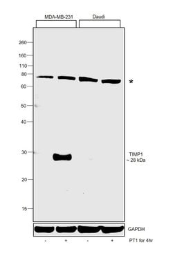 Invitrogen TIMP1 Polyclonal Antibody 100 &mu;g; Unconjugated:Antibodies,