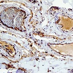 Invitrogen Eotaxin 3 Polyclonal Antibody 100 μg; Unconjugated:Antibodies,