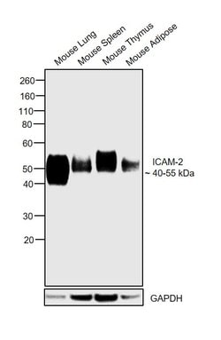 Invitrogen ICAM-2 Polyclonal Antibody 100 &mu;g | Buy Online | Invitrogen&trade; | Fisher Scientific