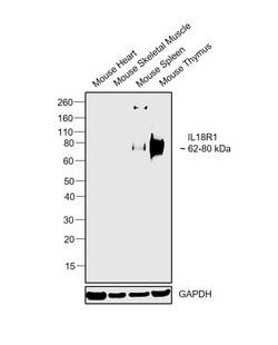 Invitrogen IL18R1 Polyclonal Antibody 100 &mu;g | Buy Online | Invitrogen&trade; | Fisher Scientific