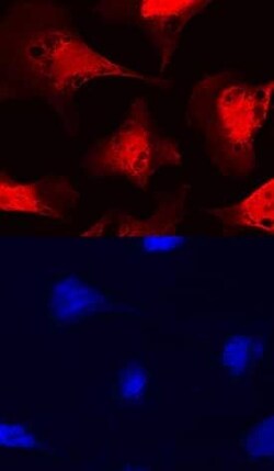 Invitrogen FUT11 Polyclonal Antibody 100 &mu;g; Unconjugated:Anticuerpos