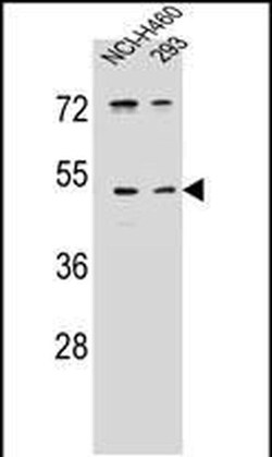 PRSS55 Rabbit anti-Human, Polyclonal, Invitrogen 400 &mu;L; Unconjugated:Antibodies,