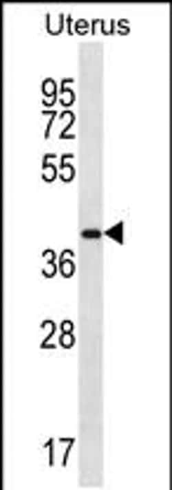 OR2V2 Rabbit anti-Human, Polyclonal, Invitrogen 400 &mu;L; Unconjugated:Antibodies,