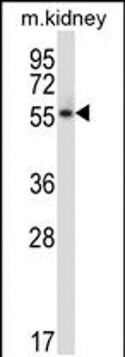 PLK5 Rabbit anti-Mouse, Polyclonal, Invitrogen 400 &mu;L; Unconjugated:Antibodies,