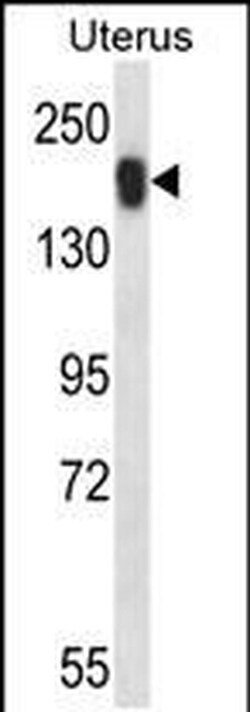 USP43 Rabbit anti-Human, Polyclonal, Invitrogen 400 &mu;L; Unconjugated:Antibodies,