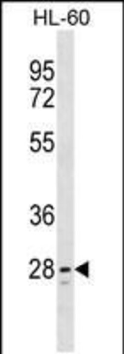 TLCD1 Rabbit anti-Human, Polyclonal, Invitrogen 400 &mu;L; Unconjugated:Antibodies,