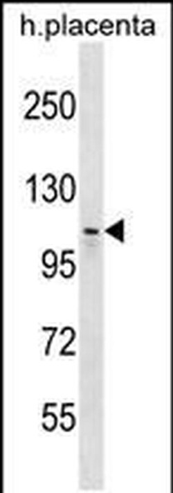 MMS19 Rabbit anti-Human, Polyclonal, Invitrogen 400 &mu;L; Unconjugated:Antibodies,
