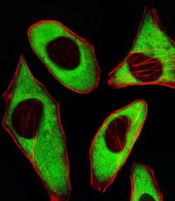 RPL6 Rabbit anti-Human, Polyclonal, Invitrogen 400 &mu;L; Unconjugated:Antibodies,