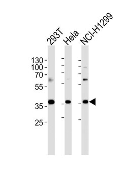 RPL6 Rabbit anti-Human, Polyclonal, Invitrogen 400 &mu;L; Unconjugated:Antibodies,