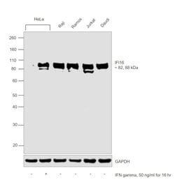 Invitrogen IFI16 Polyclonal Antibody 100 &mu;L; Unconjugated:Antibodies,