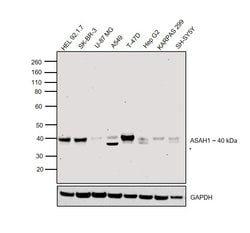 Invitrogen ASAH1 Polyclonal Antibody 100 &mu;L; Unconjugated:Antibodies,