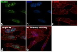 Invitrogen RAD18 Polyclonal Antibody 100 &mu;L; Unconjugated:Antibodies,