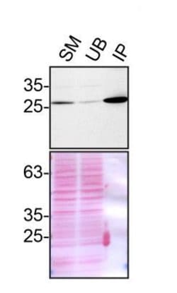Invitrogen VAPB Polyclonal Antibody 100 &mu;L; Unconjugated:Antibodies,