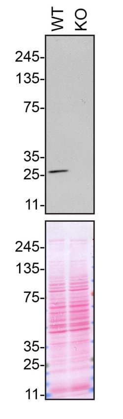 Invitrogen VAPB Polyclonal Antibody 100 &mu;L; Unconjugated:Antibodies,