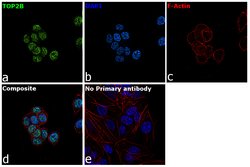 Invitrogen TOP2B Polyclonal Antibody 100 &mu;L; Unconjugated:Antibodies,
