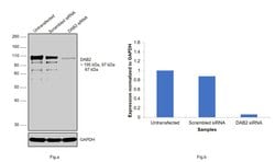 Invitrogen DAB2 Polyclonal Antibody 100 &mu;L; Unconjugated:Antibodies,