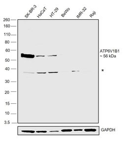 Invitrogen ATP6V1B1 Polyclonal Antibody 100 &mu;L; Unconjugated:Antibodies,