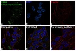 Invitrogen XRN1 Polyclonal Antibody 100 &mu;L; Unconjugated:Anticuerpos
