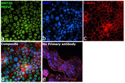 Invitrogen KMT2D Polyclonal Antibody 100 &mu;L; Unconjugated:Antibodies,