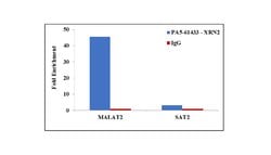 Invitrogen XRN2 Polyclonal Antibody 100 &mu;L; Unconjugated:Antibodies,