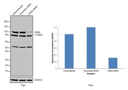 Invitrogen XRN2 Polyclonal Antibody 100 &mu;L; Unconjugated:Antibodies,