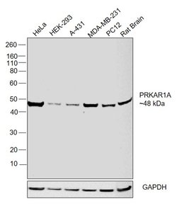 Invitrogen PRKAR1A Polyclonal Antibody 100 &mu;L; Unconjugated:Antibodies,