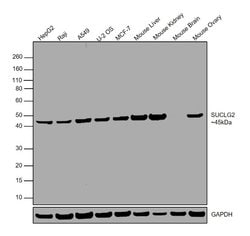 Invitrogen SUCLG2 Polyclonal Antibody 100 &mu;L | Buy Online | Invitrogen&trade; | Fisher Scientific