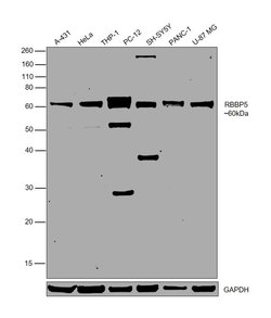 Invitrogen RBBP5 Polyclonal Antibody 100 &mu;L | Buy Online | Invitrogen&trade; | Fisher Scientific