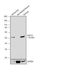 Invitrogen Cytokeratin 12 Polyclonal Antibody 100 &mu;L; Unconjugated:Antibodies,