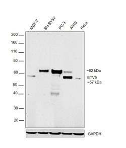 Invitrogen ETV5 Polyclonal Antibody 100 &mu;L; Unconjugated:Antibodies,