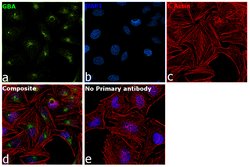 Invitrogen GBA Polyclonal Antibody 100 &mu;L; Unconjugated:Antibodies,
