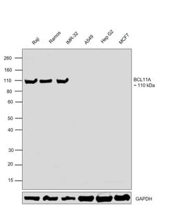 Invitrogen BCL11A Polyclonal Antibody 100 &mu;L; Unconjugated:Antibodies,