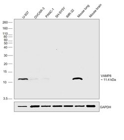 Invitrogen VAMP8 Polyclonal Antibody 100 &mu;L; Unconjugated:Antibodies,