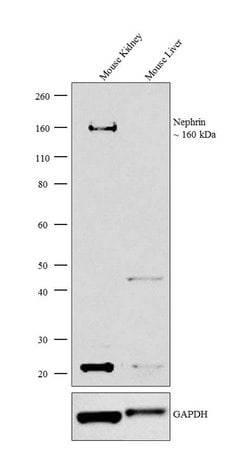 Invitrogen Nephrin Polyclonal Antibody 100 &mu;g; Unconjugated:Antibodies,