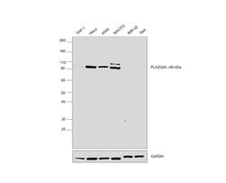 Invitrogen PLA2G4A Polyclonal Antibody 100 &mu;L | Buy Online | Invitrogen&trade; | Fisher Scientific