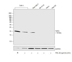 Invitrogen TSPO Polyclonal Antibody 100 &mu;L | Buy Online | Invitrogen&trade; | Fisher Scientific