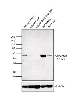 Invitrogen ATP6V1B1 Polyclonal Antibody 100 &mu;L; Unconjugated:Antibodies,