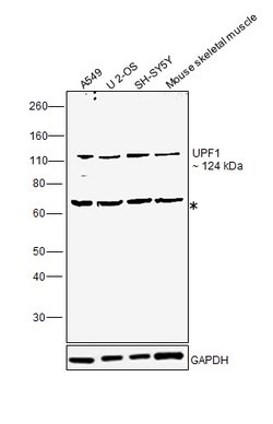 UPF1 Polyclonal Antibody:Antibodies, Polyclonal