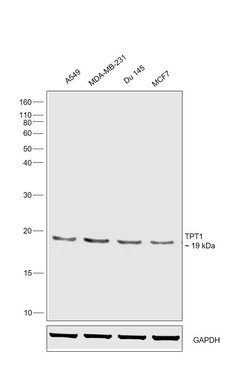 Invitrogen TPT1 Polyclonal Antibody 100 &mu;L | Buy Online | Invitrogen&trade; | Fisher Scientific