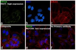 Invitrogen CPT1A Polyclonal Antibody 100 &mu;L; Unconjugated:Antibodies,