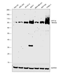Invitrogen CPT1A Polyclonal Antibody 100 &mu;L; Unconjugated:Antibodies,