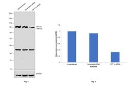 Invitrogen CPT1A Polyclonal Antibody 100 &mu;L; Unconjugated:Antibodies,