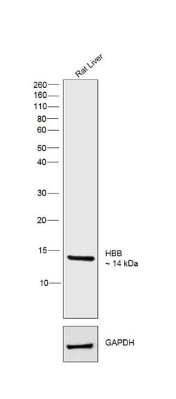 Invitrogen HBB Polyclonal Antibody 100 &mu;L; Unconjugated:Antibodies,
