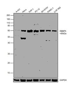 Invitrogen RBBP5 Polyclonal Antibody 100 &mu;L; Unconjugated:Antibodies,